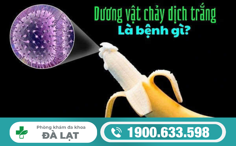 Hình ảnh minh họa